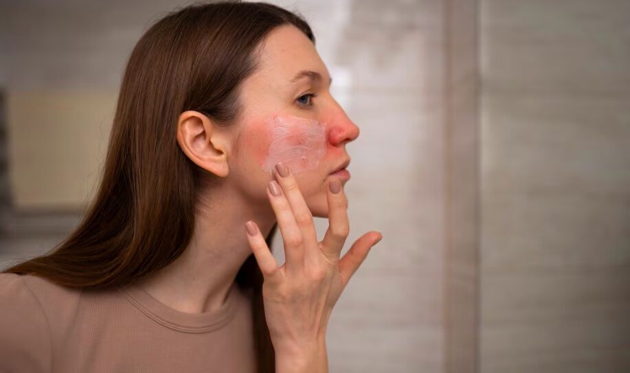 Skincare Bisa Atasi Masalah Kulit Kering Saat Puasa