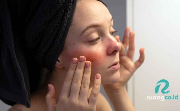 bahan skincare berbahaya