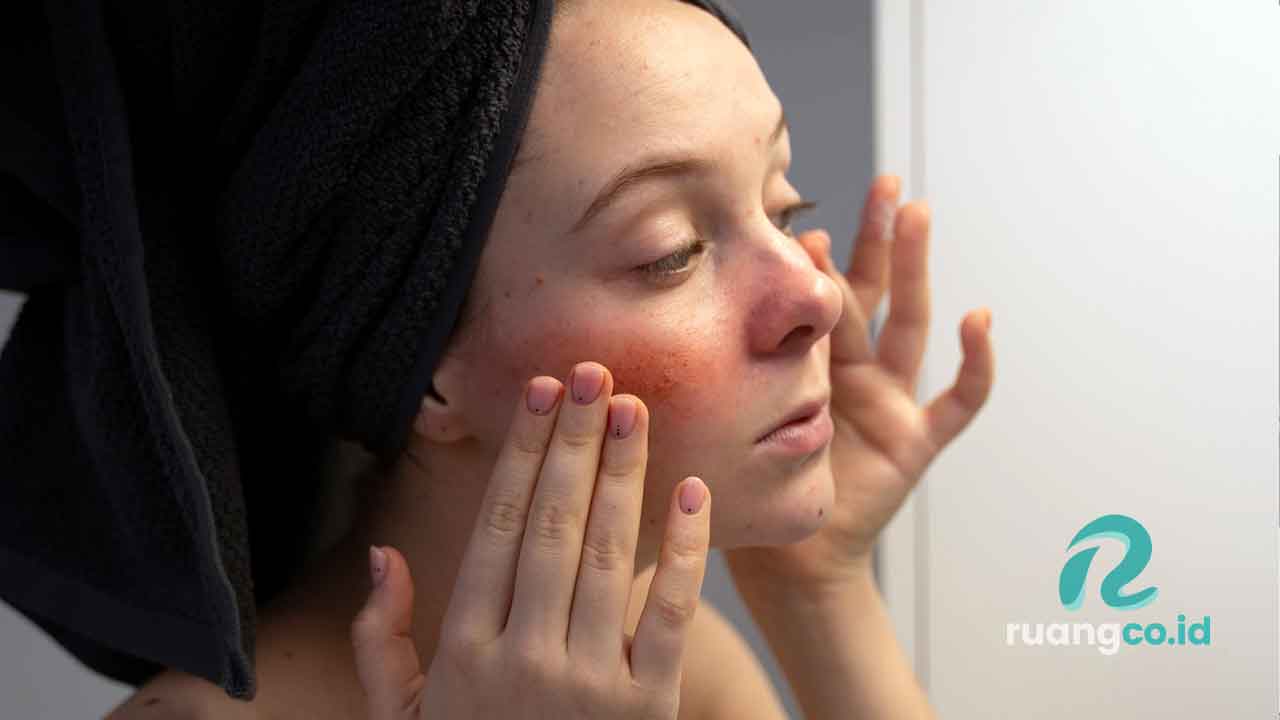 bahan skincare berbahaya