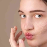 fungsi skin barrier