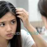 rambut beruban usia 25