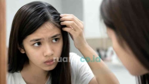 rambut beruban usia 25