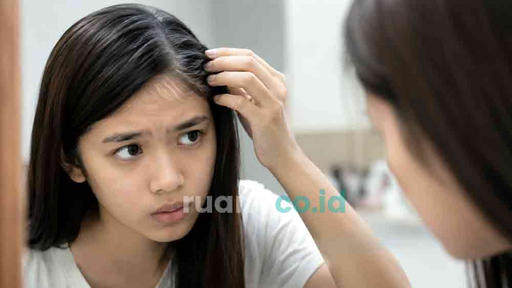 rambut beruban usia 25